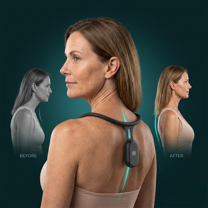 Smart Posture Corrector Wearable ™ – Back & Neck Posture Trainer Device